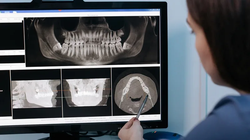 Dijital ortodonti CBCT görüntüleme ve 3D analiz