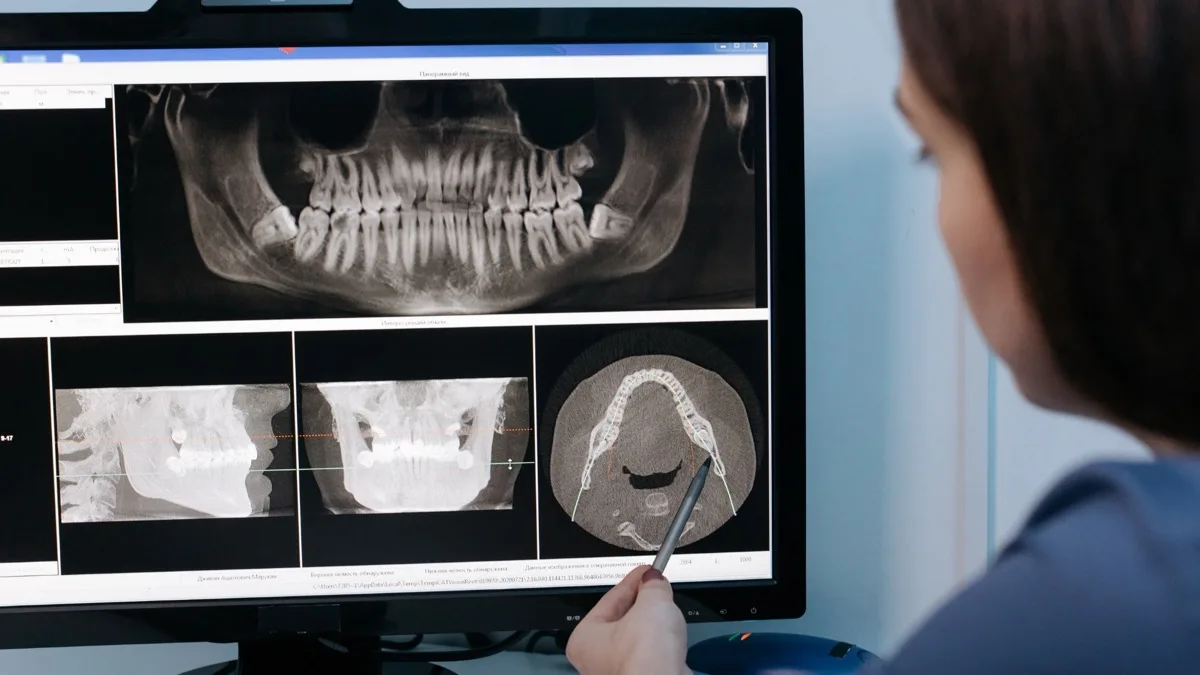 Dijital ortodonti CBCT görüntüleme ve 3D analiz